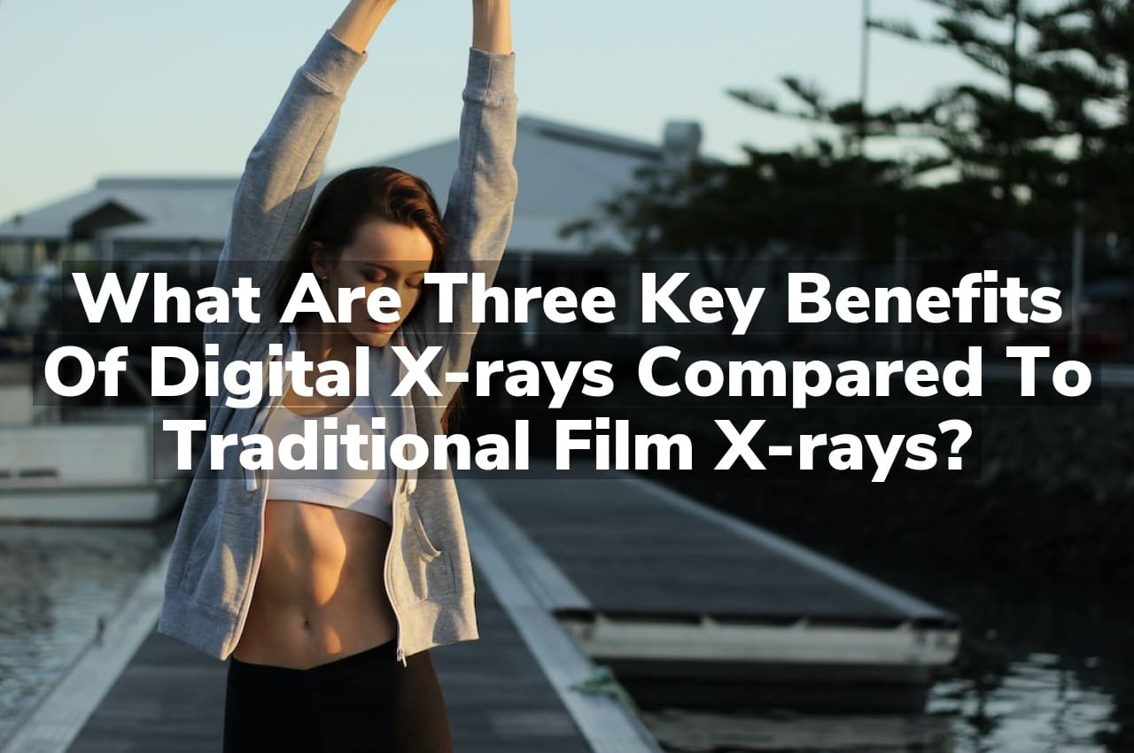 What are three key benefits of digital x-rays compared to traditional film x-rays?